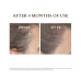 Led Light Therapy Anti Hair Loss Treatment Combo Kit, 2 Piece