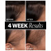 Sponsored Hair Density Scalp Treatment, 2.1 oz.