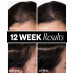 Sponsored Hair Density Scalp Treatment, 2.1 oz.