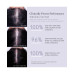 Minoxidil Topical Aerosol 5%, 2.11 oz.